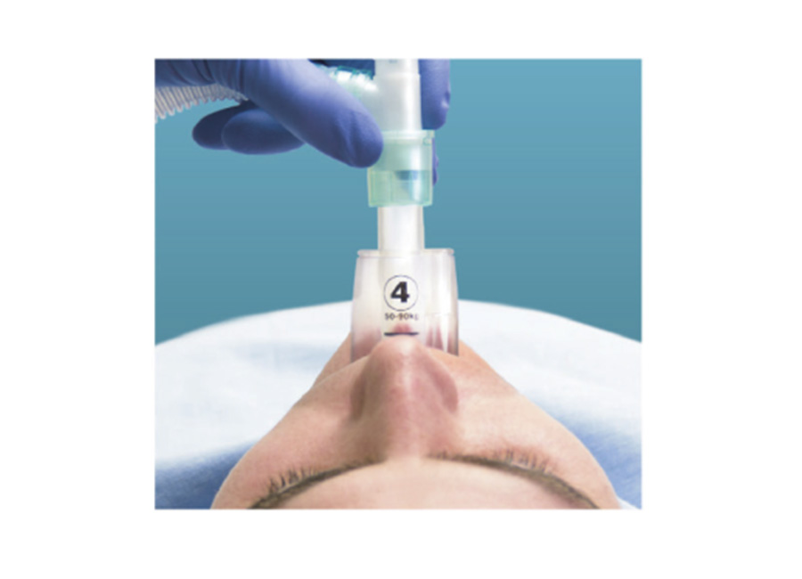 喉罩（英特赛克）